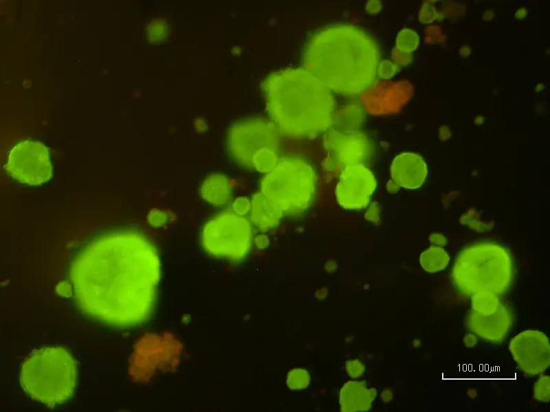 Experimental approaches to improving the efficiency of islet transplantation
