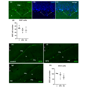 Plantar Stimulations during 3-Day Hindlimb Unloading Prevent Loss of ...