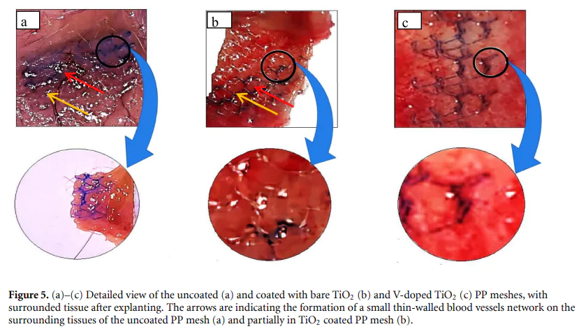 Development of antibacterial nanocoatings using atomic and molecular layer deposition nanotechnology for biomedical applications