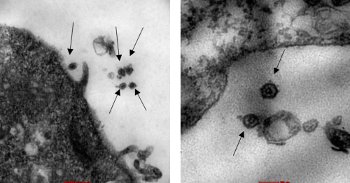 Laboratory of Molecular Virology